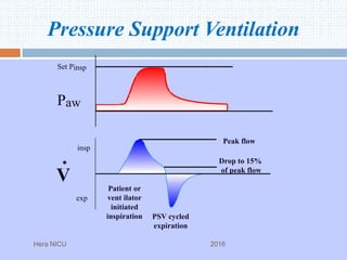 Paw
V
•
insp
exp
Patient or
vent ilator
initiated
inspiration PSV cycled
expiration
Peak flow
Drop to 15%
of peak flow
Pressure Support Ventilation
Set Pinsp
Hera NICU 2016
 