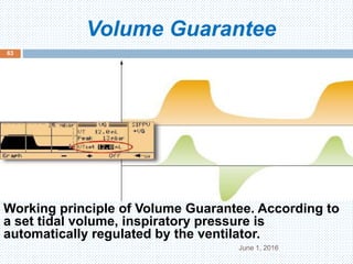 Volume Guarantee
June 1, 2016
63
Working principle of Volume Guarantee. According to
a set tidal volume, inspiratory pressure is
automatically regulated by the ventilator.
 
