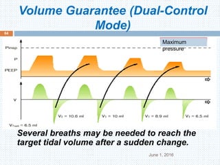Volume Guarantee (Dual-Control
Mode)
June 1, 2016
64
Several breaths may be needed to reach the
target tidal volume after a sudden change.
Maximum
pressure
 