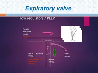 Expiratory valve
Hera NICU 2016
 