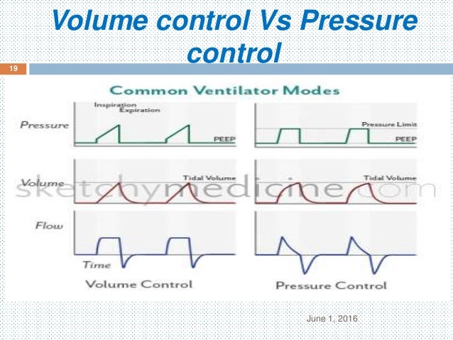 2. ventilatory modes