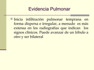 Evidencia Pulmonar
 Inicia infiltración pulmonar temprana en
forma dispersa e irregular, a menudo es más
extensa en los radiografías que indican los
signos clínicos. Puede avanzar de un lóbulo a
otro y ser bilateral
 
