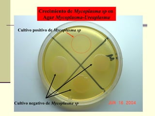 Crecimiento de Mycoplasma sp en
Agar Mycoplasma-Ureaplasma
Cultivo negativo de Mycoplasma sp
Cultivo positivo de Mycoplasma sp
 