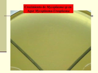 Crecimiento de Mycoplasma sp en
Agar Mycoplasma-Ureaplasma
 