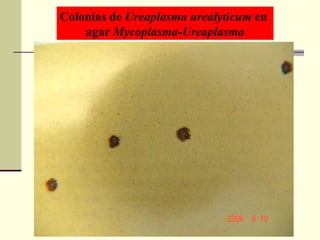 Colonias de Ureaplasma urealyticum en
agar Mycoplasma-Ureaplasma
 