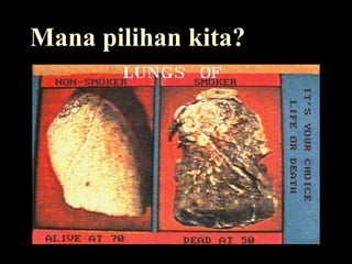 Mana pilihan kita?
 
