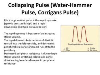 Collapsing Pulse (Water-Hammer
Pulse, Corrigans Pulse)
It is a large volume pulse with a rapid upstroke
(systolic pressure is high) and a rapid
downstroke (diastolic pressure is low).
The rapid upstroke is because of an increased
stroke volume.
The rapid downstroke is because of diastolic
run-off into the left ventricle, and decreased
peripheral resistance and rapid run-off to the
periphery.
Decreased peripheral resistance is due to large
stroke volume stretching carotid and aortic
sinus leading to reflex decrease in peripheral
resistance
 