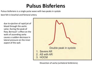 Pulsus Bisferiens
best felt in brachial and femoral artery
due to ejection of rapid jet of
blood through the aortic
valve. During the peak of
flow, Bernouli’ s effect on the
walls of ascending aorta
causes a sudden decrease in
lateral pressure on the inner
aspect of the wall.
Dissection of aorta (unilateral bisferiens).
Pulsus bisferiens is a single pulse wave with two peaks in systole
 