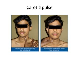 Carotid pulse
 