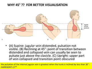 • (A) Supine: jugular vein distended, pulsation not
visible. (B) Reclining at 45°: point of transition between
distended and collapsed vein can usually be seen to
pulsate just above the clavicle. (C) Upright: upper part
of vein collapsed and transition point obscured
WHY 45° ?? FOR BETTER VISUALISATION
the pulsation of the internal jugular vein is greatest when the trunk is inclined by less than 30° :
HARRISON’S 17TH
 