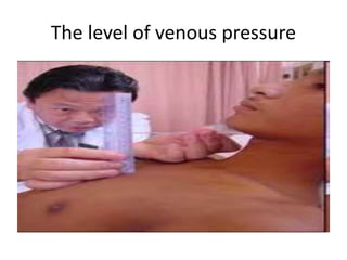 The level of venous pressure
 