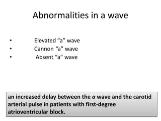 Abnormalities in a wave
• Elevated “a” wave
• Cannon “a” wave
• Absent “a” wave
an increased delay between the a wave and the carotid
arterial pulse in patients with first-degree
atrioventricular block.
 
