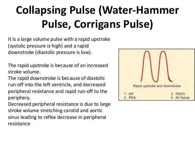 Pulse JVP Pulse JVP
