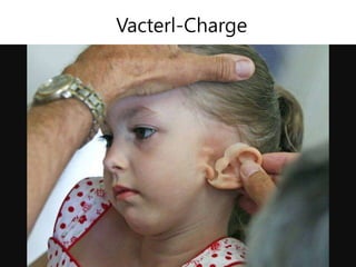 Vacterl-Charge
 