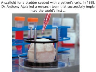A scaffold for a bladder seeded with a patient's cells. In 1999,
Dr. Anthony Atala led a research team that successfully impla
nted the world's first ...
 
