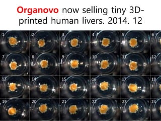 Organovo now selling tiny 3D-
printed human livers. 2014. 12
 
