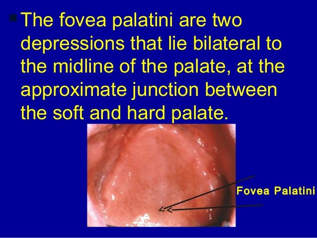 2 hand out hamular notch