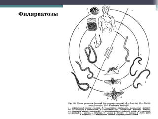 Филяриатозы
 