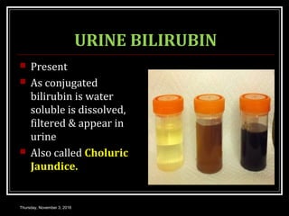 URINE BILIRUBIN
 Present
 As conjugated
bilirubin is water
soluble is dissolved,
filtered & appear in
urine
 Also called Choluric
Jaundice.
Thursday, November 3, 2016
 