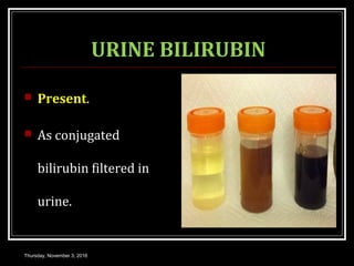 URINE BILIRUBIN
 Present.
 As conjugated
bilirubin filtered in
urine.
Thursday, November 3, 2016
 