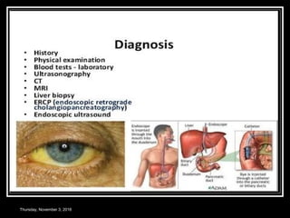 Thursday, November 3, 2016
 
