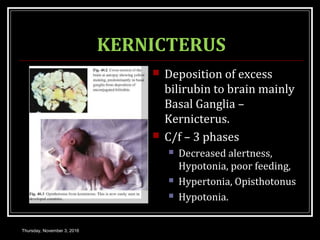 KERNICTERUS
 Deposition of excess
bilirubin to brain mainly
Basal Ganglia –
Kernicterus.
 C/f – 3 phases
 Decreased alertness,
Hypotonia, poor feeding,
 Hypertonia, Opisthotonus
 Hypotonia.
Thursday, November 3, 2016
 