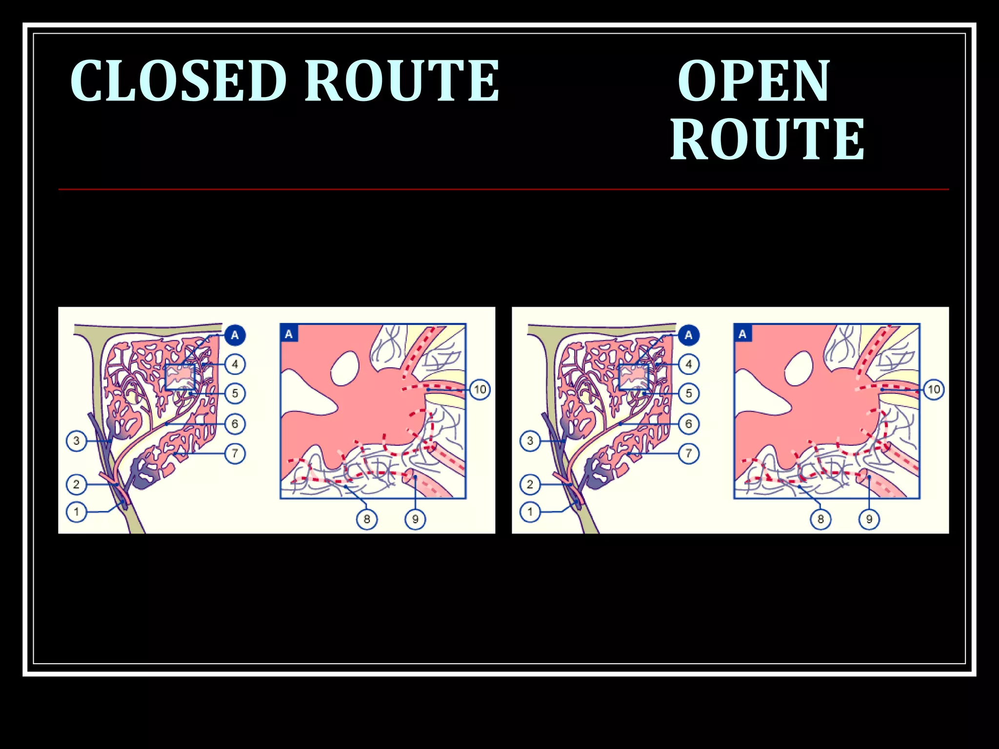 CLOSED ROUTE OPEN
ROUTE
 