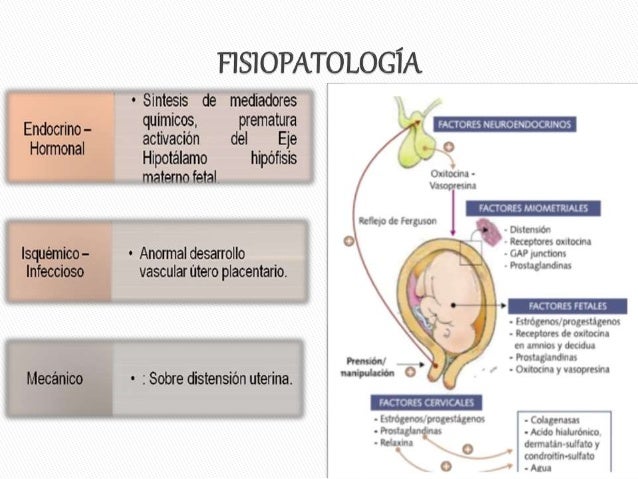 Resultado de imagen para AMENaza parto pretermino