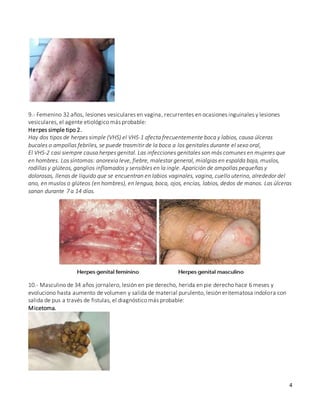 4
9.- Femenino 32 años, lesiones vesiculares en vagina, recurrentes en ocasiones inguinales y lesiones
vesiculares, el agente etiológico más probable:
Herpes simple tipo 2.
Hay dos tipos de herpes simple (VHS) el VHS-1 afecta frecuentemente boca y labios, causa úlceras
bucales o ampollas febriles, se puede trasmitir de la boca a los genitales durante el sexo oral,
El VHS-2 casi siempre causa herpes genital. Las infecciones genitales son más comunes en mujeres que
en hombres. Los síntomas: anorexia leve, fiebre, malestar general, mialgias en espalda baja, muslos,
rodillas y glúteos, ganglios inflamados y sensibles en la ingle. Aparición de ampollas pequeñas y
dolorosas, llenas de líquido que se encuentran en labios vaginales, vagina, cuello uterino, alrededor del
ano, en muslos o glúteos (en hombres), en lengua, boca, ojos, encías, labios, dedos de manos. Las úlceras
sanan durante 7 a 14 días.
10.- Masculino de 34 años jornalero, lesión en pie derecho, herida en pie derecho hace 6 meses y
evoluciono hasta aumento de volumen y salida de material purulento, lesión eritematosa indolora con
salida de pus a través de fistulas, el diagnóstico más probable:
Micetoma.
 