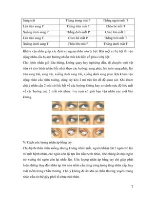 7
Sang trái Thẳng trong mắt P Thẳng ngoài mắt T
Lên trên sang P Thẳng trên mắt P Chéo bé mắt T
Xuống dưới sang P Thẳng dưới mắt P Chéo lớn mắt T
Lên trên sang T Chéo bé mắt P Thẳng trên mắt T
Xuống dưới sang T Chéo lớn mắt P Thẳng dưới mắt T
Khám vận nhãn giúp xác định cơ ngoại nhãn nào bị liệt. Khi một cơ bị liệt thì vận
động nhãn cầu bị ảnh hưởng nhiều nhất khi liếc về phía cơ bị liệt.
Cho bệnh nhân giữ đầu thẳng, không quay hay nghiêng đầu, di chuyển một vật
tiêu và cho bệnh nhân liếc nhìn theo các hướng: sang phải, lên trên sang phải, lên
trên sang trái, sang trái, xuống dưới sang trái, xuống dưới sang phải. Khi khám vận
động nhãn cầu nhìn xuống, dùng tay kéo 2 mi trên lên để dễ quan sát. Khi khám
chú ý nhãn cầu 2 mắt có liếc hết về các hướng không hay so sánh mức độ liếc mắt
về các hướng của 2 mắt với nhau tìm xem có giới hạn vận nhãn của một bên
không.
V/ Cách ước lượng nhãn áp bằng tay
Cho bệnh nhân nhìn xuống nhưng không nhắm mắt, người khám đặt 2 ngón trỏ lên
mi mắt bệnh nhân, các ngón còn lại tựa lên đầu bệnh nhân, nhẹ nhàng ấn một ngón
trỏ xuống thì ngón còn lại nhấc lên. Ước lượng nhãn áp bằng tay chỉ giúp phát
hiện những thay đổi nhãn áp lớn như nhãn cầu căng cứng trong tăng nhãn cấp, hay
mắt mềm trong chấn thương. Chú ý không đè ấn khi có chấn thương xuyên thủng
nhãn cầu có thể gây phòi tổ chức nội nhãn.
 