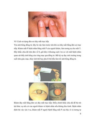 8
VI/ Cách sử dụng đèn soi đáy mắt trực tiếp
Tìm ánh hồng đồng tử: đây là việc làm trước tiên khi soi đáy mắt bằng đèn soi trực
tiếp. Khám mắt P bệnh nhân bằng mắt P của người khám, làm tương tự cho mắt T.
Đẩy khấc chia độ trên đèn về 0, giữ đèn ở khoảng cách 1m so với mắt bệnh nhân
quan sát thấy ánh hồng của võng mạc qua đồng tử. Bất kỳ sự đục môi trường trong
suốt như giác mạc, thủy tinh thể hay pha lê thể đều làm tối ánh hồng đồng tử.
Khám đáy mắt bằng đèn soi đáy mắt trực tiếp: Điều chỉnh khấc chia độ để bù trừ
tật khúc xạ nếu có của người khám và bệnh nhân nếu không đeo kính. Bệnh nhân
định thị vào vật ở xa, khám mắt P người bệnh bằng mắt P của bác sĩ và tương tự
 