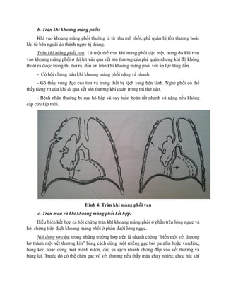 b. Tràn khí khoang màng phổi:
Khí vào khoang màng phổi thường là từ nhu mô phổi, phế quản bị tổn thương hoặc
khí từ bên ngoài do thành ngực bị thủng.
Tràn khí màng phổi van: Là một thể tràn khí màng phổi đặc biệt, trong đó khí tràn
vào khoang màng phổi ở thì hít vào qua vết tổn thương của phế quản nhưng khí đó không
thoát ra được trong thì thở ra, dẫn tới tràn khí khoang màng phổi với áp lực tăng dần.
- Có hội chứng tràn khí khoang màng phổi nặng và nhanh.
- Gõ thấy vùng đục của tim và trung thất bị lệch sang bên lành. Nghe phổi có thể
thấy tiếng rít của khí đi qua vết tổn thương khí quản trong thì thở vào.
- Bệnh nhân thường bị suy hô hấp và suy tuần hoàn rất nhanh và nặng nếu không
cấp cứu kịp thời.
Hình 4. Tràn khí màng phổi van
c. Tràn máu và khí khoang màng phổi kết hợp:
Biểu hiện kết hợp cả hội chứng tràn khí khoang màng phổi ở phần trên lồng ngực và
hội chứng tràn dịch khoang màng phổi ở phần dưới lồng ngực.
Nội dung sơ cứu: trong những trường hợp trên là nhanh chóng “biến một vết thương
hở thành một vết thương kín” bằng cách dùng một miếng gạc bôi parafin hoặc vaseline,
băng keo hoặc dùng một mảnh nilon, cao su sạch nhanh chóng đắp vào vết thương và
băng lại. Trước đó có thể chèn gạc vô vết thương nếu thấy máu chảy nhiều; chọc hút khí
 