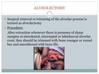 ALVEOLECTOMY
 Surgical removal or trimming of the alveolar process is
termed as alveolectomy
 Procedure:
After extraction whenever there is presence of sharp
margins at interdental, interseptal or labiobuccal alveolar
crest, they should be trimmed with bone rounger or round
bur and smoothened with bone file.
 