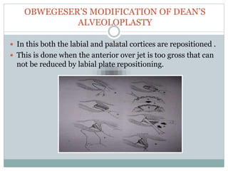 OBWEGESER’S MODIFICATION OF DEAN’S
ALVEOLOPLASTY
 In this both the labial and palatal cortices are repositioned .
 This is done when the anterior over jet is too gross that can
not be reduced by labial plate repositioning.
 