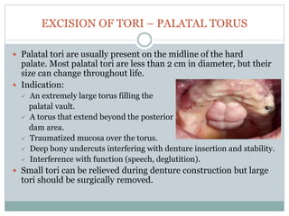EXCISION OF TORI – PALATAL TORUS
 Palatal tori are usually present on the midline of the hard
palate. Most palatal tori are less than 2 cm in diameter, but their
size can change throughout life.
 Indication:
 An extremely large torus filling the
palatal vault.
 A torus that extend beyond the posterior
dam area.
 Traumatized mucosa over the torus.
 Deep bony undercuts interfering with denture insertion and stability.
 Interference with function (speech, deglutition).
 Small tori can be relieved during denture construction but large
tori should be surgically removed.
 