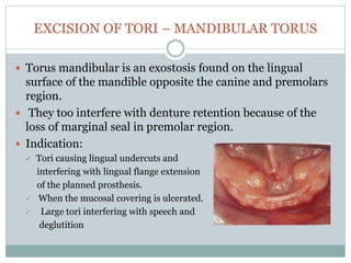 EXCISION OF TORI – MANDIBULAR TORUS
 Torus mandibular is an exostosis found on the lingual
surface of the mandible opposite the canine and premolars
region.
 They too interfere with denture retention because of the
loss of marginal seal in premolar region.
 Indication:
 Tori causing lingual undercuts and
interfering with lingual flange extension
of the planned prosthesis.
 When the mucosal covering is ulcerated.
 Large tori interfering with speech and
deglutition
 