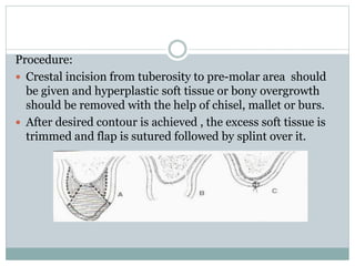 Procedure:
 Crestal incision from tuberosity to pre-molar area should
be given and hyperplastic soft tissue or bony overgrowth
should be removed with the help of chisel, mallet or burs.
 After desired contour is achieved , the excess soft tissue is
trimmed and flap is sutured followed by splint over it.
 