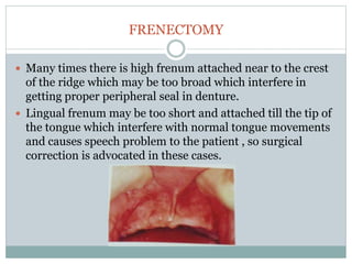 FRENECTOMY
 Many times there is high frenum attached near to the crest
of the ridge which may be too broad which interfere in
getting proper peripheral seal in denture.
 Lingual frenum may be too short and attached till the tip of
the tongue which interfere with normal tongue movements
and causes speech problem to the patient , so surgical
correction is advocated in these cases.
 