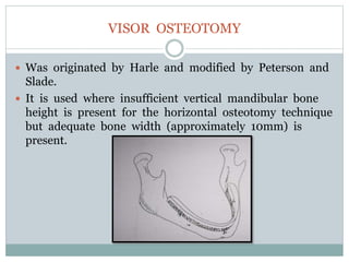VISOR OSTEOTOMY
 Was originated by Harle and modified by Peterson and
Slade.
 It is used where insufficient vertical mandibular bone
height is present for the horizontal osteotomy technique
but adequate bone width (approximately 10mm) is
present.
 