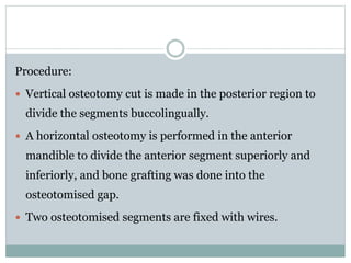 Procedure:
 Vertical osteotomy cut is made in the posterior region to
divide the segments buccolingually.
 A horizontal osteotomy is performed in the anterior
mandible to divide the anterior segment superiorly and
inferiorly, and bone grafting was done into the
osteotomised gap.
 Two osteotomised segments are fixed with wires.
 