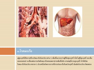 ผู้สูบบุหรี่มีโอกาสที่จะเกิดมะเร็งในอวัยวะต่างๆ เพิ่มขึ้นมากกว่าผู้ที่ไม่สูบบุหรี่ ทั้งนี้ ผู้ที่สูบบุหรี่ และดื่ม
แอลกอฮอล์ จะเสี่ยงต่อการเกิดโรคมะเร็งหลอดอาหารเพิ่มขึ้นอีก สาเหตุที่การสูบบุหรี่ ทาให้เกิด
โรคมะเร็งในอวัยวะหลายๆ ส่วนหนึ่งเกิดจากการที่สารก่อมะเร็งในควันบุหรี่ สัมผัสกับอวัยวะโดยตรง
๑.โรคมะเร็ง
 