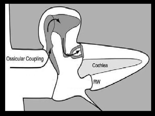 Physiology of hearing and balance | PPT