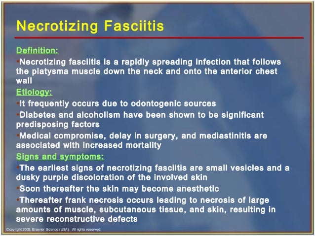 skin treatment hospital Complex odontogenic infections