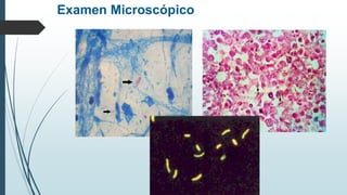 Examen Microscópico
 