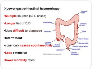 Lower gastrointestinal haemorrhage-
•Multiple sources (40% cases)
•Longer list of D/D
•More difficult to diagnose
•Intermittent
•commonly ceases spontaneously
•Less extensive
•lower mortality rates
 