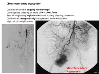 Mesenteric artery angiography
Can only be used in ongoing haemorrhage
Can diagnose bleeding at a rate of 0.5-1.0mL/min
Best for diagnosing angiodysplasia and actively bleeding diverticula
Can be used therapeutically- vasopressors and embolization
High risk of complications
Selective
mesenteric
Mesenteric artery
angiography
 