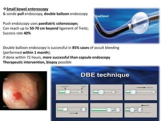 Small bowel enteroscopy
& sonde pull endoscopy, double balloon endoscopy
Push endoscopy uses paediatric colonoscope;
Can reach up to 50-70 cm beyond ligament of Treitz;
Success rate 40%
Double balloon endoscopy is successful in 85% cases of occult bleeding
(performed within 1 month);
if done within 72 hours, more successful than capsule endoscopy
Therapeutic intervention, biopsy possible
 