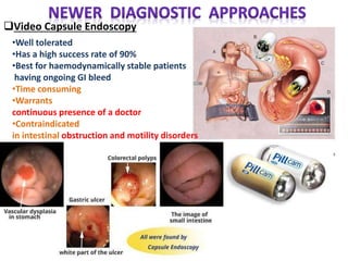 Video Capsule Endoscopy
•Well tolerated
•Has a high success rate of 90%
•Best for haemodynamically stable patients
having ongoing GI bleed
•Time consuming
•Warrants
continuous presence of a doctor
•Contraindicated
in intestinal obstruction and motility disorders
 