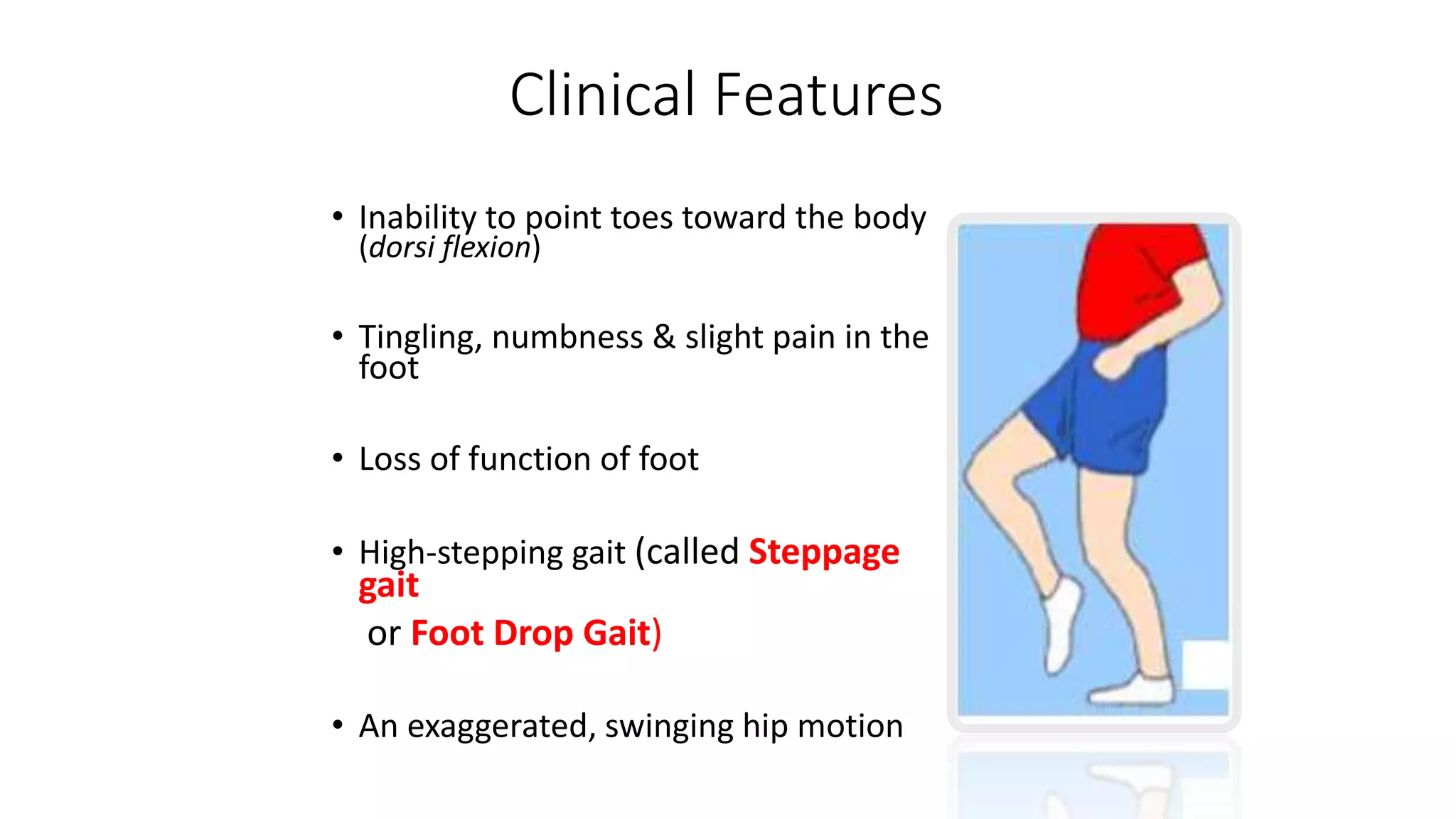 Clinical Features
• Inability to point toes toward the body
(dorsi flexion)
• Tingling, numbness & slight pain in the
foot
• Loss of function of foot
• High-stepping gait (called Steppage
gait
or Foot Drop Gait)
• An exaggerated, swinging hip motion
 