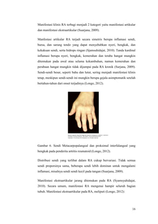 16
Manifestasi klinis RA terbagi menjadi 2 kategori yaitu manifestasi artikular
dan manifestasi ekstraartikular (Suarjana, 2009).
Manfestasi artikular RA terjadi secara simetris berupa inflamasi sendi,
bursa, dan sarung tendo yang dapat menyebabkan nyeri, bengkak, dan
kekakuan sendi, serta hidrops ringan (Sjamsuhidajat, 2010). Tanda kardinal
inflamasi berupa nyeri, bengkak, kemerahan dan teraba hangat mungkin
ditemukan pada awal atau selama kekambuhan, namun kemerahan dan
perabaan hangat mungkin tidak dijumpai pada RA kronik (Surjana, 2009).
Sendi-sendi besar, seperti bahu dan lutut, sering menjadi manifestasi klinis
tetap, meskipun sendi-sendi ini mungkin berupa gejala asimptomatik setelah
bertahun-tahun dari onset terjadinya (Longo, 2012).
Gambar 6. Sendi Metacarpopalangeal dan proksimal interfalangeal yang
bengkak pada penderita artritis reumatoid (Longo, 2012).
Distribusi sendi yang terlibat dalam RA cukup bervariasi. Tidak semua
sendi proporsinya sama, beberapa sendi lebih dominan untuk mengalami
inflamasi, misalnya sendi sendi kecil pada tangan (Suarjana, 2009).
Manifestasi ekstraartikular jarang ditemukan pada RA (Syamsyuhidajat,
2010). Secara umum, manifestasi RA mengenai hampir seluruh bagian
tubuh. Manifestasi ekstraartikular pada RA, meliputi (Longo, 2012):
 